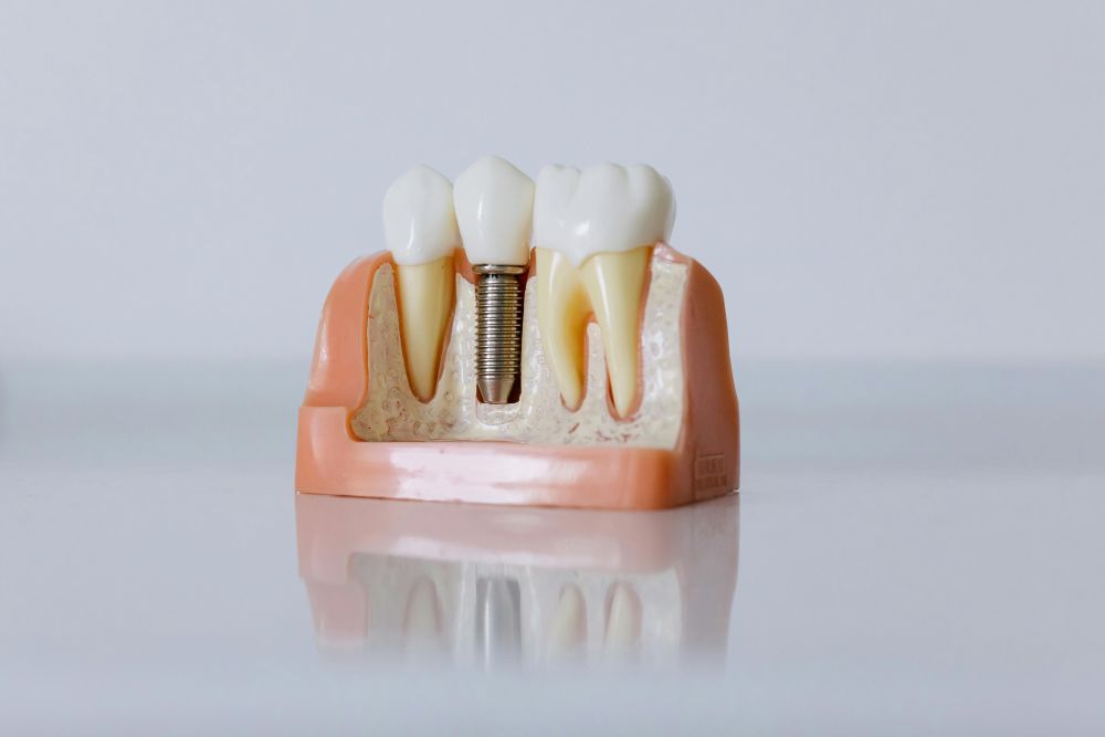 Cosmetic Dental Longevity