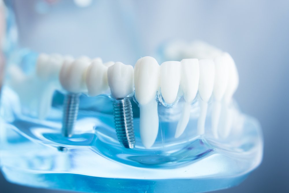 4 Myths About Dentistry (Debunked!)