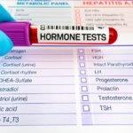 natural hormone therapy in Beverly Hills