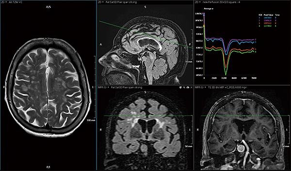 Multi-modality imaging