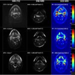 Multi-modality imaging