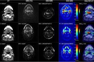 Multi-modality imaging