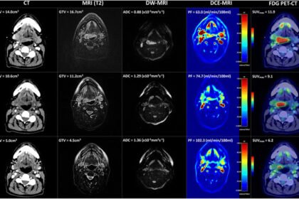 Multi-modality imaging