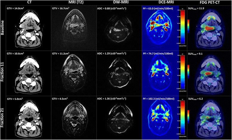 Multi-modality imaging