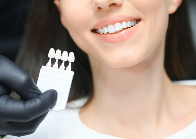 How Long Do Cosmetic Dentals Last?