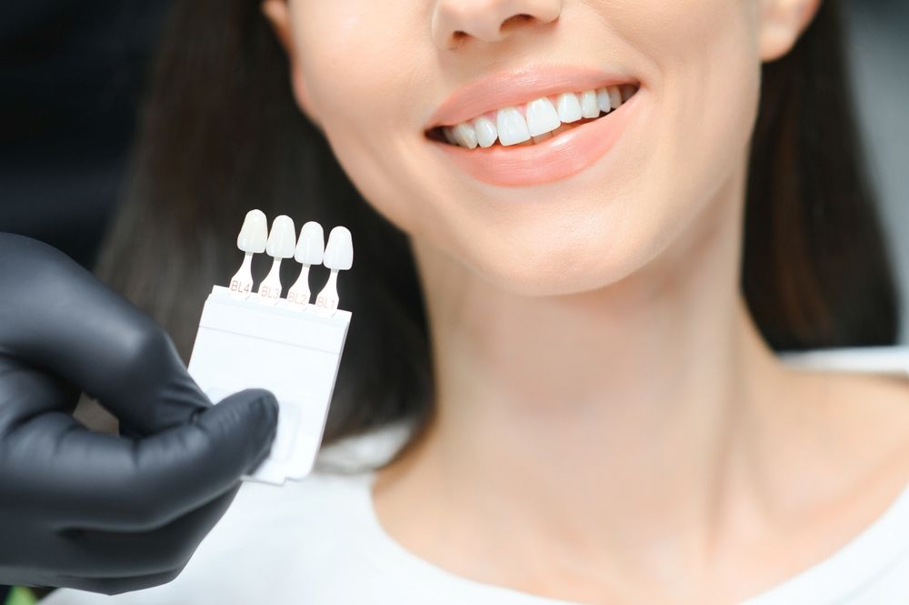 How Long Do Cosmetic Dentals Last?